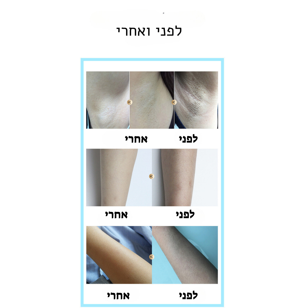 מכשיר לייזר להסרת שיער-IPL- LOVEDOCK מבית-BoSidin