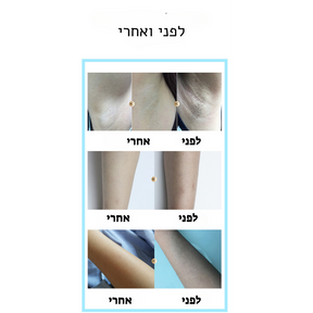 מכשיר לייזר להסרת שיער-IPL- LOVEDOCK מבית-BoSidin